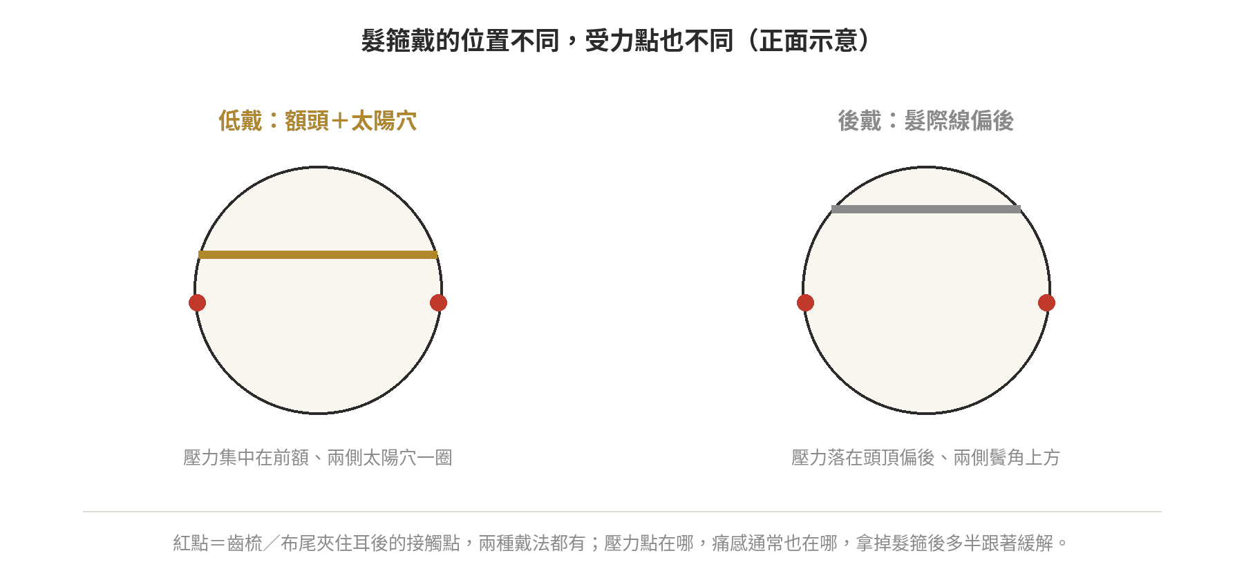 髮箍戴的位置不同受力點示意:額頭低戴壓力集中在前額與太陽穴,髮際線後戴壓力落在頭頂偏後與鬢角上方